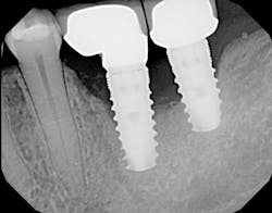 1506deyoo P19 1506deyoo P19