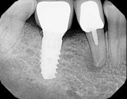 1506deyoo P20 1506deyoo P20