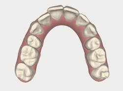 1511defor P01 1511defor P01