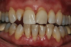 1511defor P03 1511defor P03