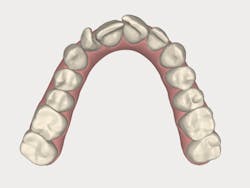 1511defor P04 1511defor P04