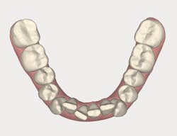 1511defor P05 1511defor P05