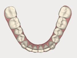 1511defor P07 1511defor P07