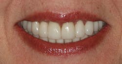 1511defor P08 1511defor P08