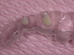 1511defor P13 1511defor P13