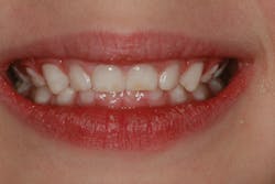 Bru Image001 Bru Image001