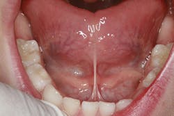 Bru Image003 Bru Image003