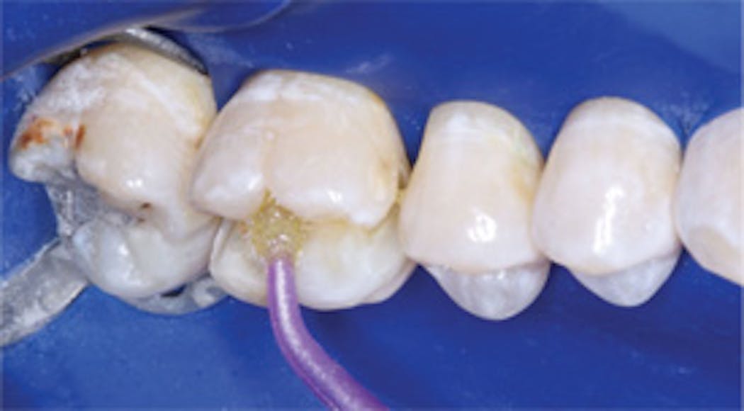 Ch Fig5