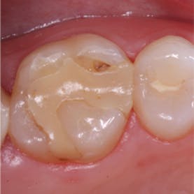 Essential requirements of a non-occlusal mandibu- lar reference