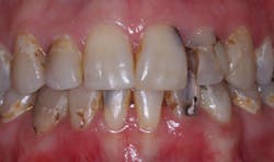 Chr Slide7 Chr Slide7