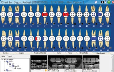 Dentimax Image Charting Screen For Dental Econmics