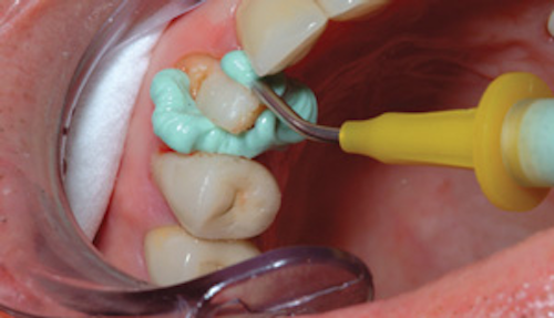 Ditollaoctober 2013figure 1