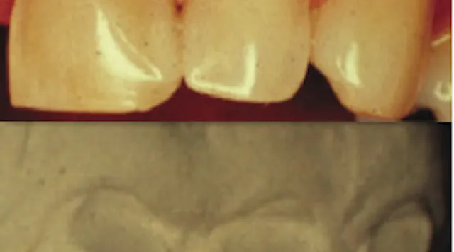 The importance of making and retaining diagnostic casts | Dental Economics