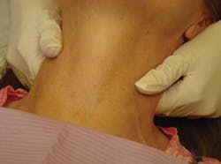 Glasscoe Dianne De April 2013 Eo Exam Picture5 Glasscoe Dianne De April 2013 Eo Exam Picture5