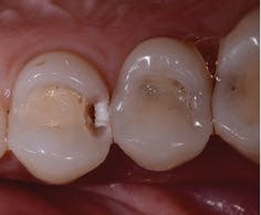 Initial Prep Fmt Initial Prep Fmt