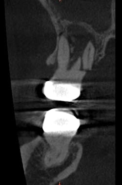 Mcallisterhires2 Mcallisterhires2