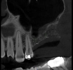 Mcallisterhires3 Copy Mcallisterhires3 Copy