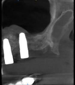 Mcallisterhires4 Mcallisterhires4