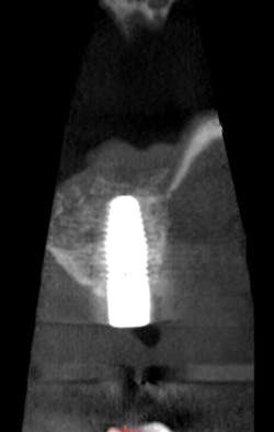 Mcallisterhires5 Mcallisterhires5