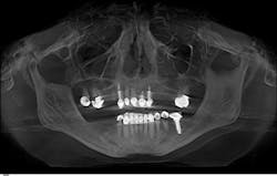 New Agarwal Image Of Xray New Agarwal Image Of Xray