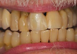 Nylaan Dr Brian De July 12 After Photo Mg 6858 Nylaan Dr Brian De July 12 After Photo Mg 6858