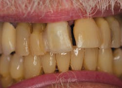 Nylaan Dr Brian De July 12 Before Mg 6855 Nylaan Dr Brian De July 12 Before Mg 6855