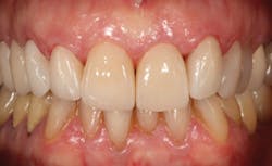 P1406defer05 P1406defer05