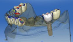 P1408depat11 P1408depat11