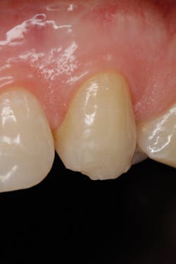 P1409degla01 P1409degla01