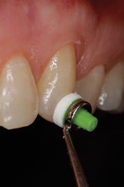 P1409degla02 P1409degla02