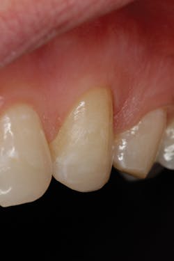 P1409degla03 P1409degla03