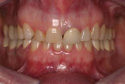 P1409deyoo1a P1409deyoo1a