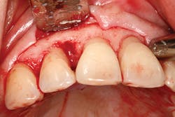 P1409deyoo3a P1409deyoo3a