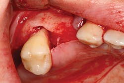 P1409deyoo3b P1409deyoo3b