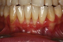 P1409deyoo4a P1409deyoo4a