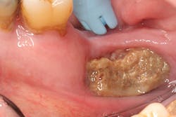 P1409deyoo5b P1409deyoo5b