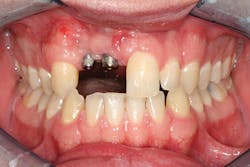 P1409deyoo6b P1409deyoo6b