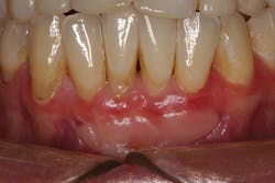 P1409deyoo7d P1409deyoo7d