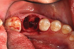 P1409deyoo8a P1409deyoo8a