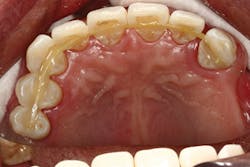 P1409deyoo8b P1409deyoo8b