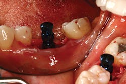 P1409deyoo9a P1409deyoo9a