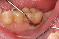 P1410defro01 P1410defro01