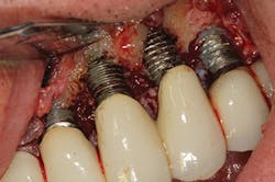 P1410defro04 P1410defro04