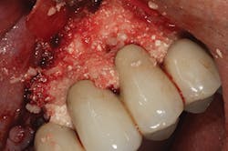 P1410defro05 P1410defro05