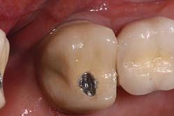 P1410denot02 P1410denot02