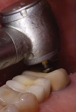 P1410denot03 P1410denot03