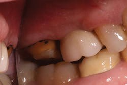 P1410denot04 P1410denot04