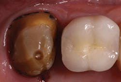 P1410denot05 P1410denot05