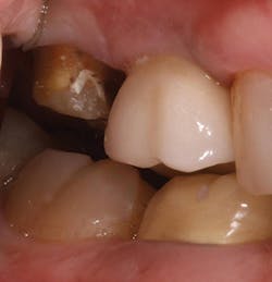 P1410denot06 P1410denot06