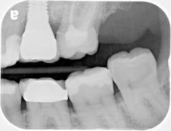 P1410denot09 P1410denot09